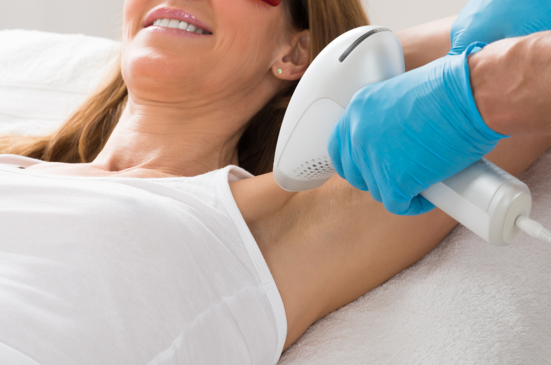 Paciente recostada mientras recibe tratamiento de depilación láser en centro estético de Cali